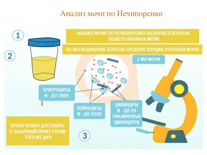 Анализ мочи по Нечипоренко