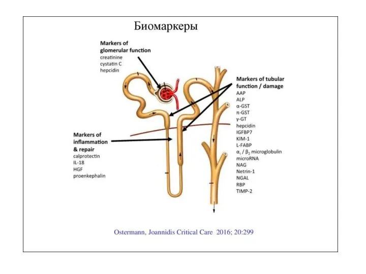 Биомаркеры повреждения почек Интерлейкин -18 –значительно повышается при остром повреждении почек. KIM-1(kidney