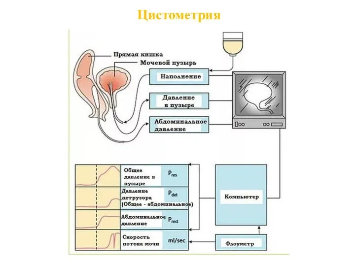 Цистометрия