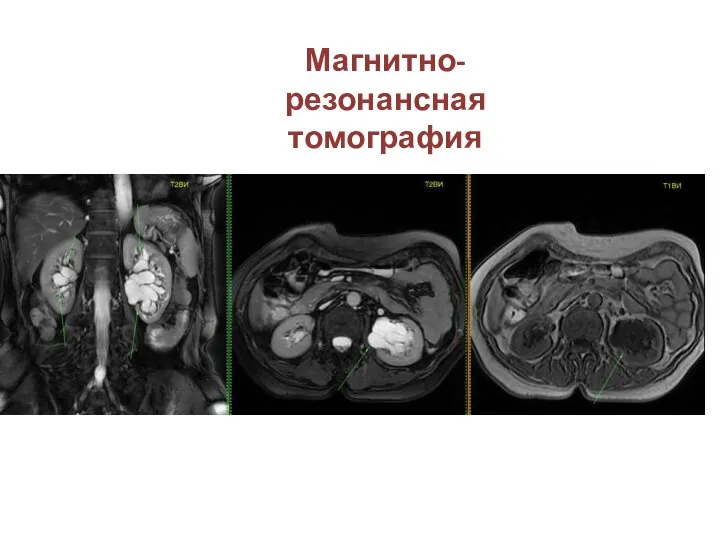 Магнитно-резонансная томография