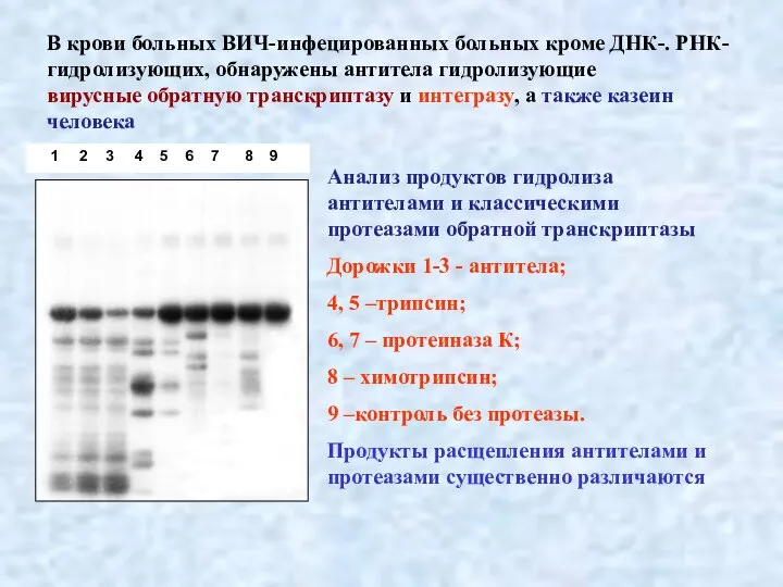 В крови больных ВИЧ-инфецированных больных кроме ДНК-. РНК- гидролизующих, обнаружены антитела гидролизующие