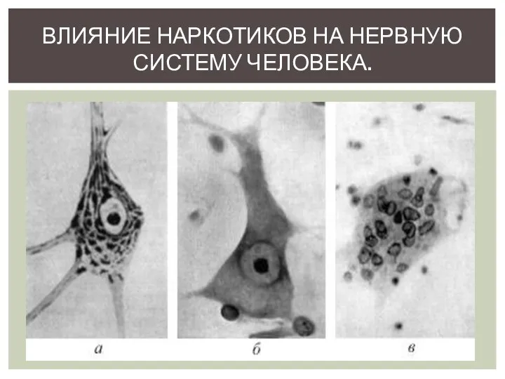 ВЛИЯНИЕ НАРКОТИКОВ НА НЕРВНУЮ СИСТЕМУ ЧЕЛОВЕКА.