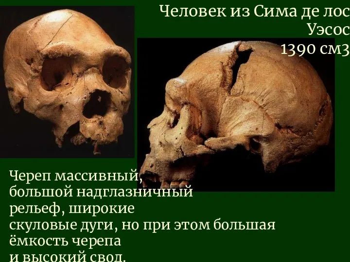 Человек из Сима де лос Уэсос 1390 см3 Череп массивный, большой надглазничный