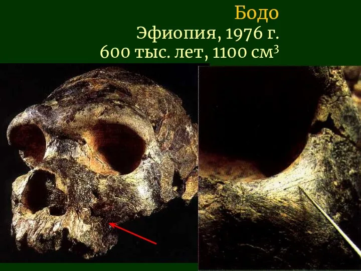 Бодо Эфиопия, 1976 г. 600 тыс. лет, 1100 см3