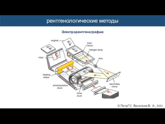 © ПетрГУ, Васильев В. А., 2021 рентгенологические методы Электрорентгенография