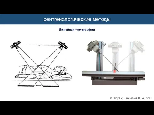© ПетрГУ, Васильев В. А., 2021 рентгенологические методы Линейная томография