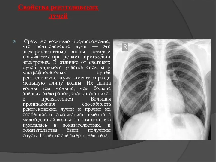 Свойства рентгеновских лучей Сразу же возникло предположение, что рентгеновские лучи — это