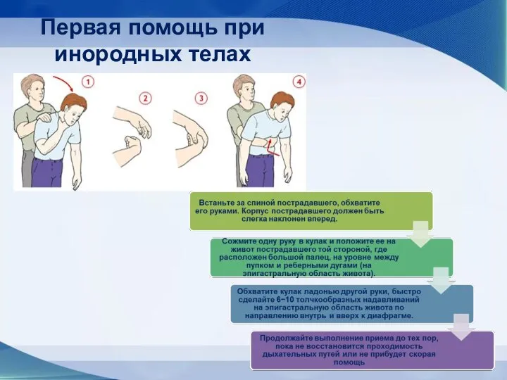 Первая помощь при инородных телах