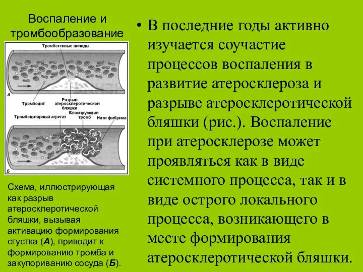 Воспаление и тромбообразование В последние годы активно изучается соучастие процессов воспаления в