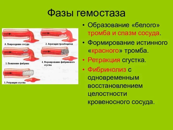 Фазы гемостаза Образование «белого» тромба и спазм сосуда. Формирование истинного «красного» тромба.