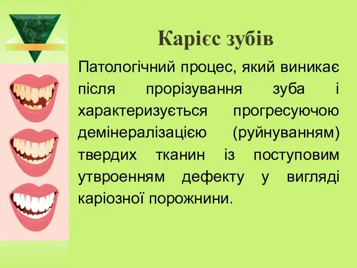 Карієс зубів Патологічний процес, який виникає після прорізування зуба і характеризується прогресуючою