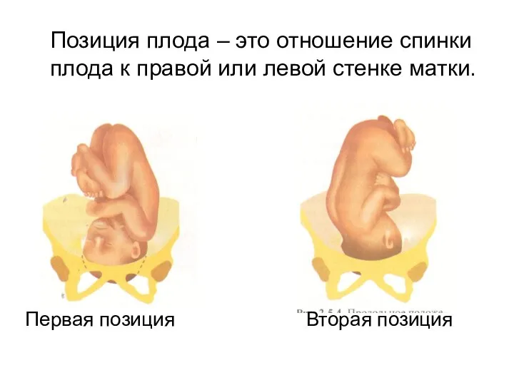 Позиция плода – это отношение спинки плода к правой или левой стенке