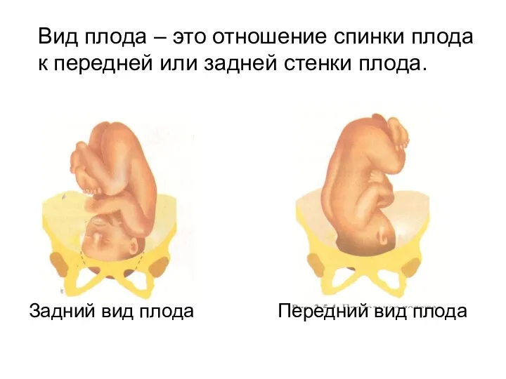 Вид плода – это отношение спинки плода к передней или задней стенки