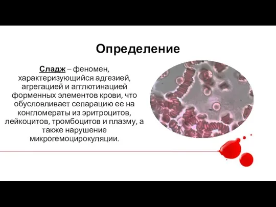 Определение Сладж – феномен, характеризующийся адгезией, агрегацией и агглютинацией форменных элементов крови,