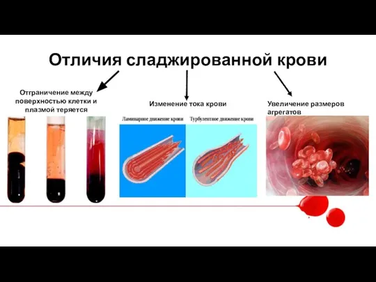 Отличия сладжированной крови Отграничение между поверхностью клетки и плазмой теряется Изменение тока крови Увеличение размеров агрегатов