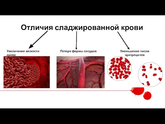 Отличия сладжированной крови Увеличение вязкости крови Потеря формы сосудов Уменьшение числа эритроцитов