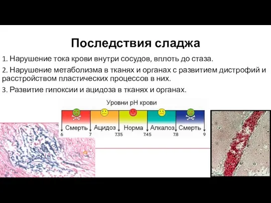 Последствия сладжа 1. Нарушение тока крови внутри сосудов, вплоть до стаза. 2.