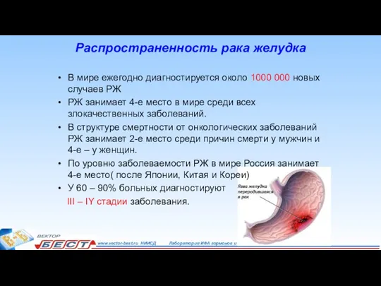 Распространенность рака желудка В мире ежегодно диагностируется около 1000 000 новых случаев