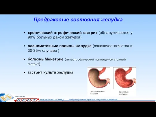 Предраковые состояния желудка хронический атрофический гастрит (обнаруживается у 90% больных раком желудка)