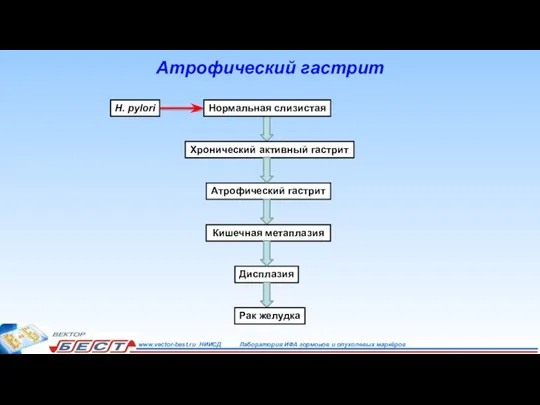 Атрофический гастрит Нормальная слизистая Хронический активный гастрит H. pylori Атрофический гастрит Кишечная метаплазия Дисплазия Рак желудка