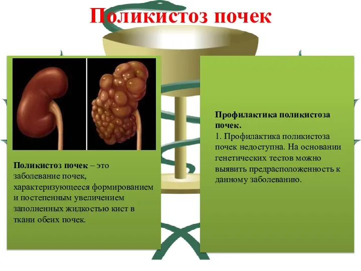 Поликистоз почек – это заболевание почек, характеризующееся формированием и постепенным увеличением заполненных