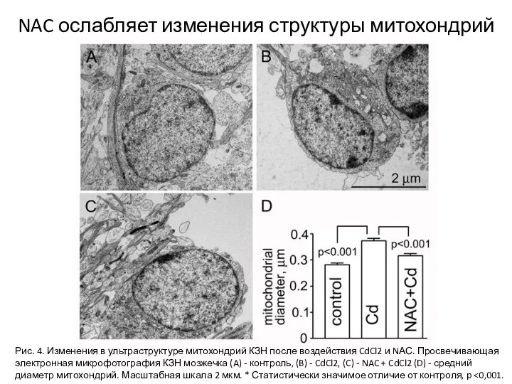 NAC ослабляет изменения структуры митохондрий Рис. 4. Изменения в ультраструктуре митохондрий КЗН