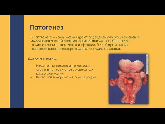 Патогенез Изменение содержания половых стероидных гормонов в локальном кровотоке матки. Клеточная гиперплазия,