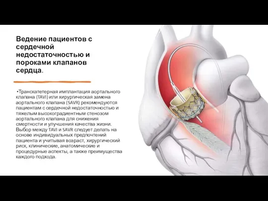 Ведение пациентов с сердечной недостаточностью и пороками клапанов сердца. Транскатетерная имплантация аортального