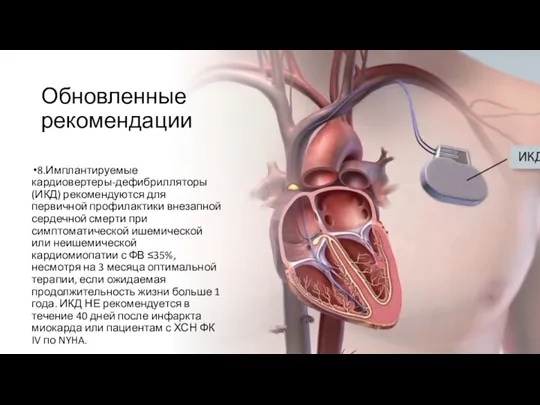 Обновленные рекомендации 8.Имплантируемые кардиовертеры-дефибрилляторы (ИКД) рекомендуются для первичной профилактики внезапной сердечной смерти
