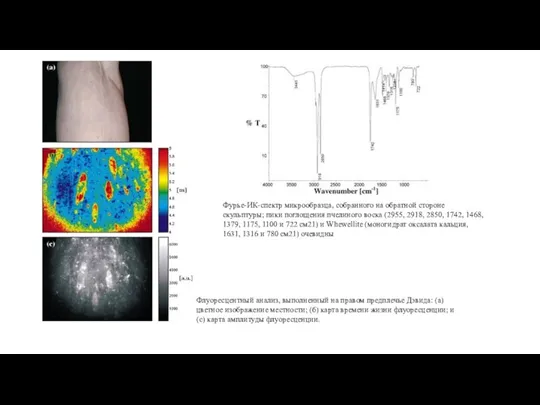 Флуоресцентный анализ, выполненный на правом предплечье Дэвида: (а) цветное изображение местности; (б)