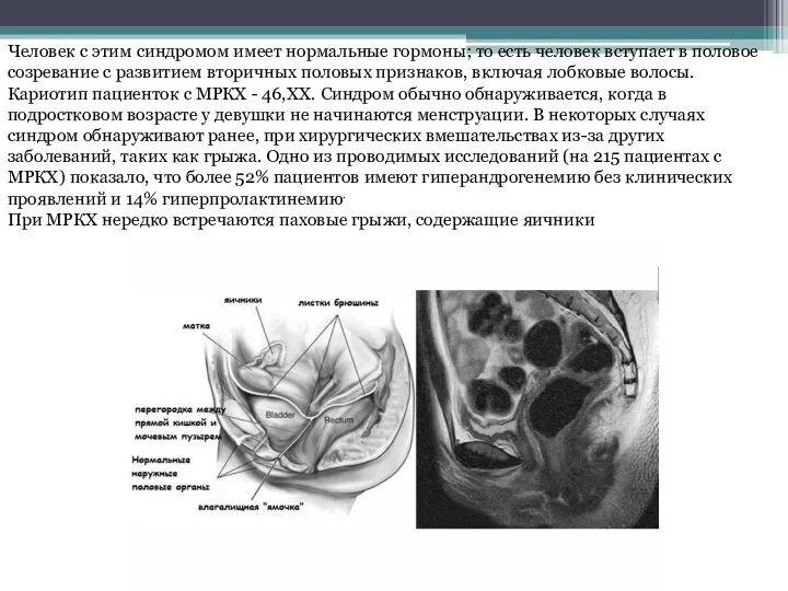 Человек с этим синдромом имеет нормальные гормоны; то есть человек вступает в