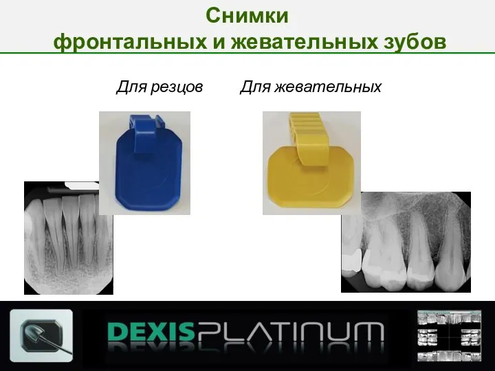 Для резцов Для жевательных Снимки фронтальных и жевательных зубов