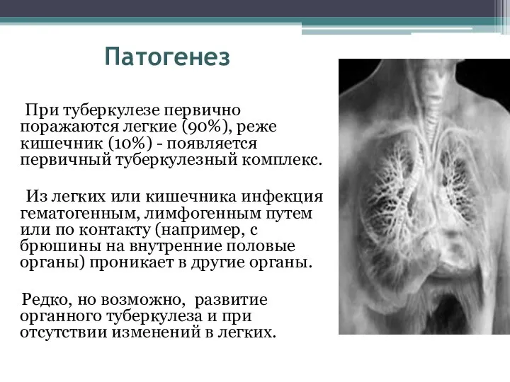 Патогенез При туберкулезе первично поражаются легкие (90%), реже кишечник (10%) - появляется