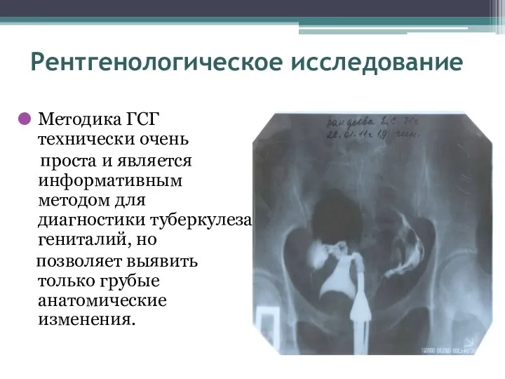 Рентгенологическое исследование Методика ГСГ технически очень проста и является информативным методом для