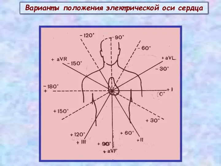 Варианты положения электрической оси сердца