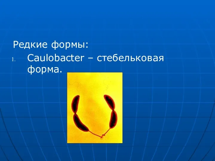 Редкие формы: Caulobacter – стебельковая форма.