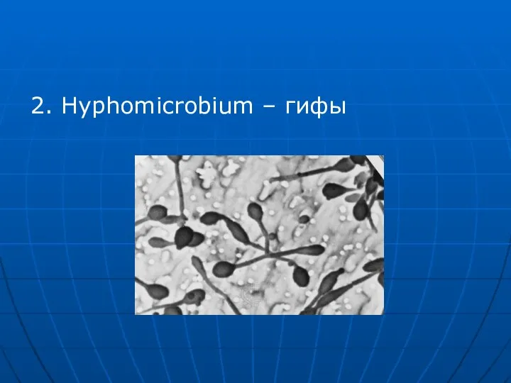 2. Hyphomicrobium – гифы