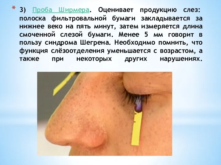 3) Проба Ширмера. Оценивает продукцию слез: полоска фильтровальной бумаги закладывается за нижнее