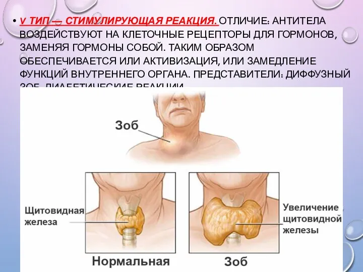 V ТИП — СТИМУЛИРУЮЩАЯ РЕАКЦИЯ. ОТЛИЧИЕ: АНТИТЕЛА ВОЗДЕЙСТВУЮТ НА КЛЕТОЧНЫЕ РЕЦЕПТОРЫ ДЛЯ