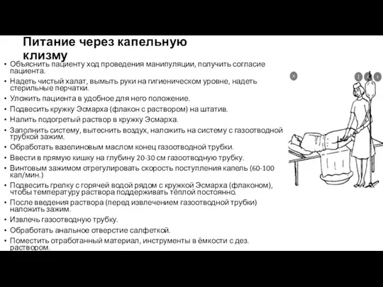 Питание через капельную клизму Объяснить пациенту ход проведения манипуляции, получить согласие пациента.