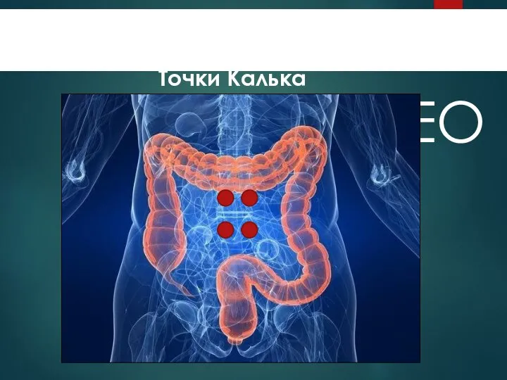 Точки Калька ENDOVIDEOSURGERY Пневмоперитонеум