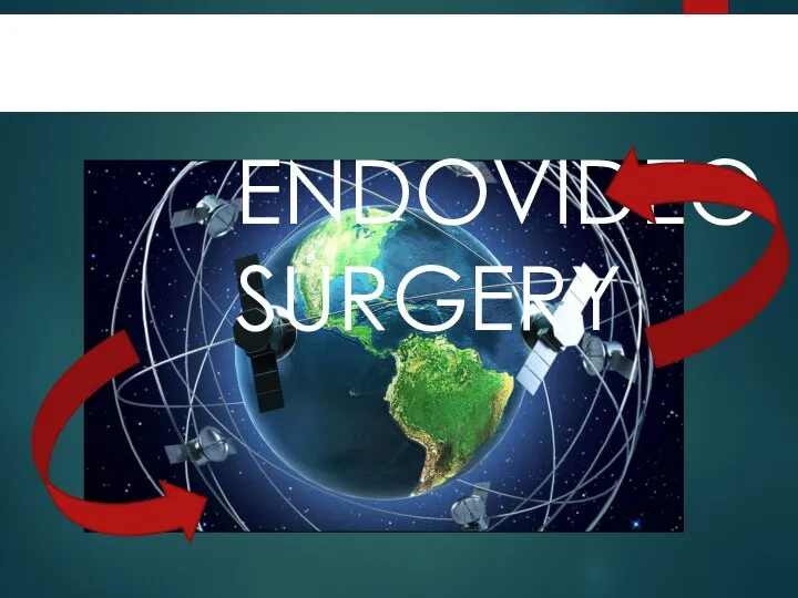 2-ИСПОЛЬЗУЙ РОТАЦИЮ ENDOVIDEOSURGERY