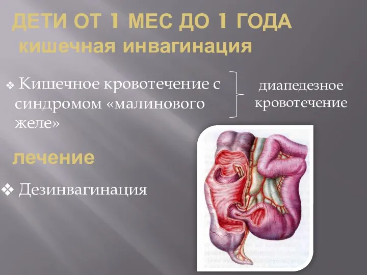 ДЕТИ ОТ 1 МЕС ДО 1 ГОДА кишечная инвагинация Кишечное кровотечение с