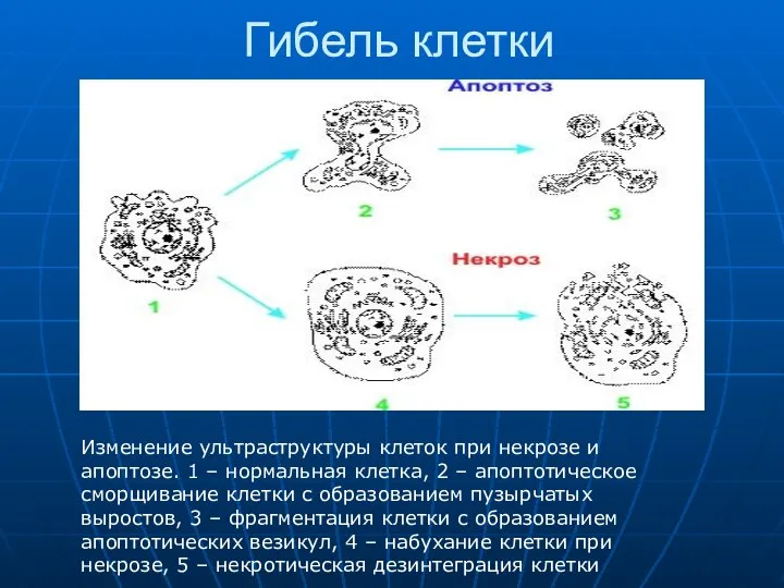 Гибель клетки Изменение ультраструктуры клеток при некрозе и апоптозе. 1 – нормальная