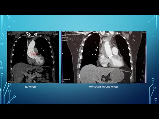 до опер контроль после опер