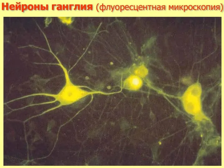 Нейроны ганглия (флуоресцентная микроскопия)
