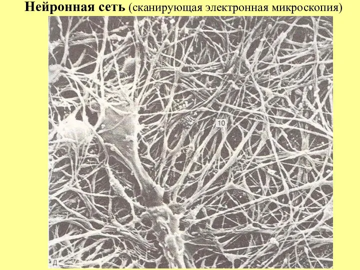 Нейронная сеть (сканирующая электронная микроскопия)