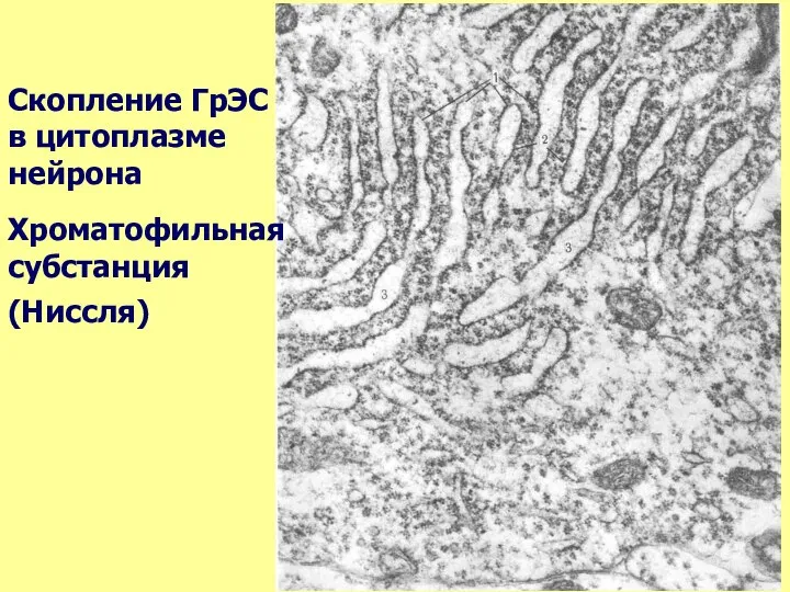 Скопление ГрЭС в цитоплазме нейрона Хроматофильная субстанция (Ниссля)