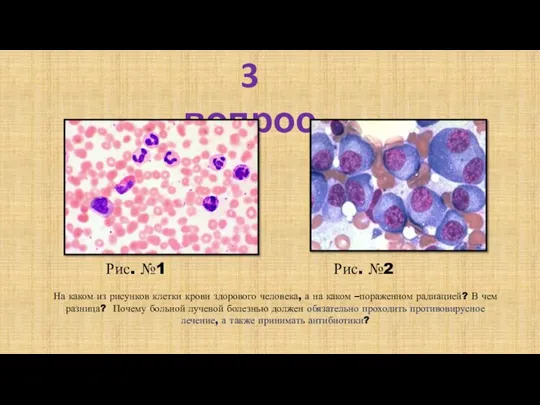 3 вопрос Рис. №1 Рис. №2 На каком из рисунков клетки крови