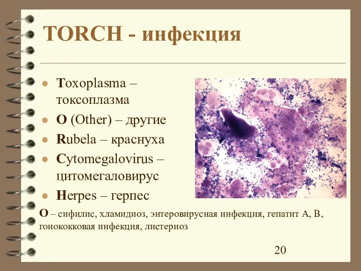 TORCH - инфекция Toxoplasma – токсоплазма O (Other) – другие Rubela –